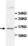 Western blot - Anti-Iba1 antibody - Microglia marker (AB108539)
