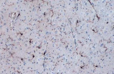 Immunohistochemistry (Formalin/PFA-fixed paraffin-embedded sections) - Anti-Iba1 antibody - Microglia marker (AB153696)