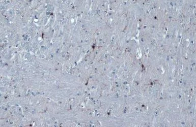 Immunohistochemistry (Formalin/PFA-fixed paraffin-embedded sections) - Anti-Iba1 antibody - Microglia marker (AB153696)