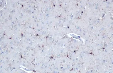 Immunohistochemistry (Formalin/PFA-fixed paraffin-embedded sections) - Anti-Iba1 antibody - Microglia marker (AB153696)