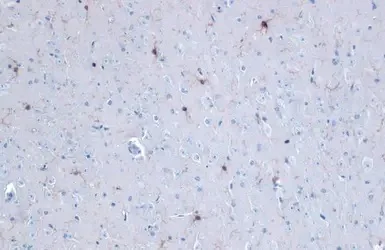 Immunohistochemistry (Formalin/PFA-fixed paraffin-embedded sections) - Anti-Iba1 antibody - Microglia marker (AB153696)