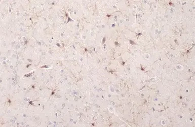 Immunohistochemistry (Formalin/PFA-fixed paraffin-embedded sections) - Anti-Iba1 antibody - Microglia marker (AB153696)