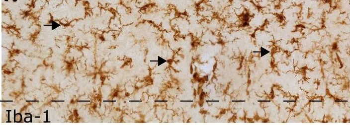 Immunohistochemistry (Formalin/PFA-fixed paraffin-embedded sections) - Anti-Iba1 antibody - Microglia marker (AB5076)