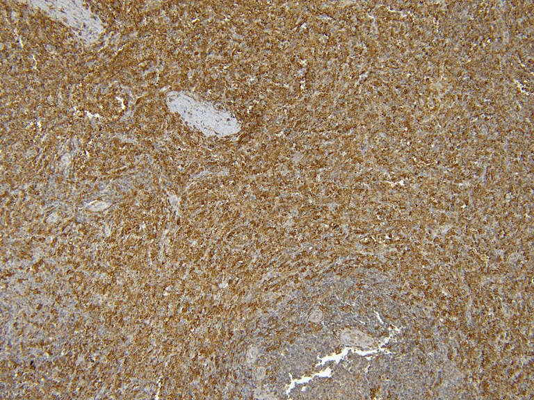 Immunohistochemistry (Formalin/PFA-fixed paraffin-embedded sections) - Anti-Iba1 antibody - Microglia marker (AB5076)