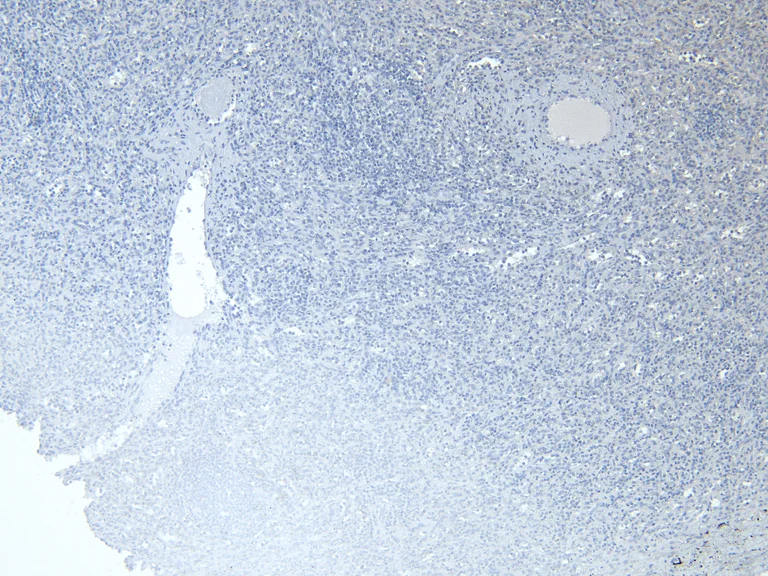 Immunohistochemistry (Formalin/PFA-fixed paraffin-embedded sections) - Anti-Iba1 antibody - Microglia marker (AB5076)
