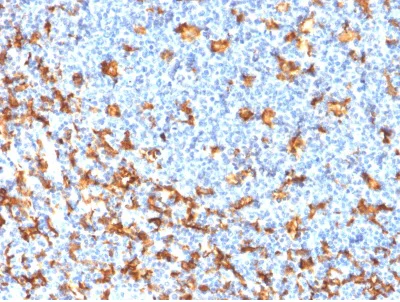 Immunohistochemistry (Formalin/PFA-fixed paraffin-embedded sections) - Anti-Iba1 antibody [rAIF1/1909] - Microglia marker (AB237988)