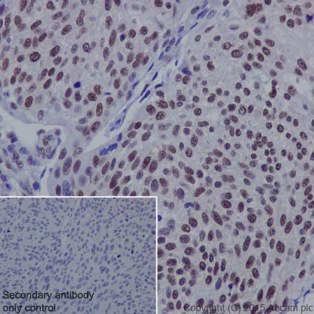 Immunohistochemistry (Formalin/PFA-fixed paraffin-embedded sections) - Anti-IBP160 antibody [EPR16942] (AB205303)
