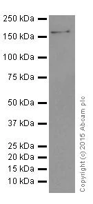 Western blot - Anti-IBP160 antibody [EPR16942] (AB205303)