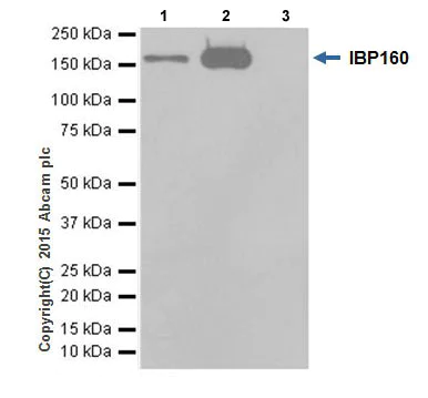 Immunoprecipitation - Anti-IBP160 antibody [EPR16942] - BSA and Azide free (AB251425)