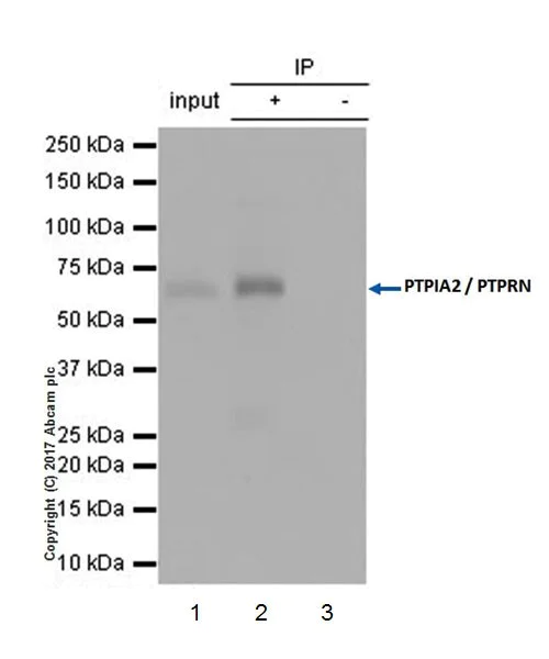 Immunoprecipitation - Anti-ICA 512/PTPRN antibody [EPR20718] (AB207750)