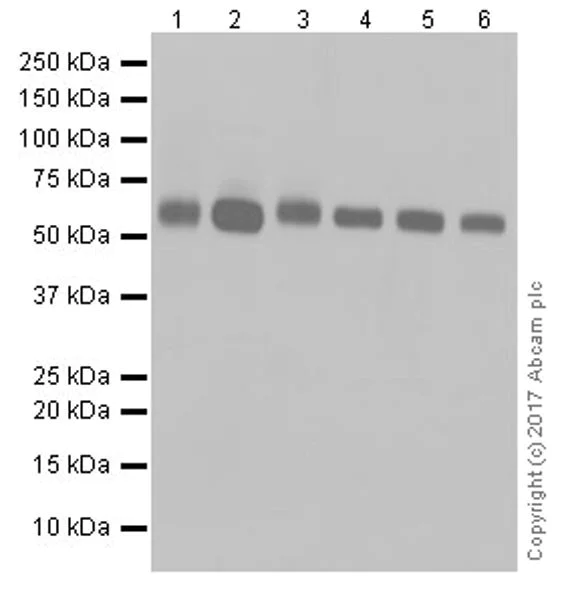 Western blot - Anti-ICA 512/PTPRN antibody [EPR20718] (AB207750)
