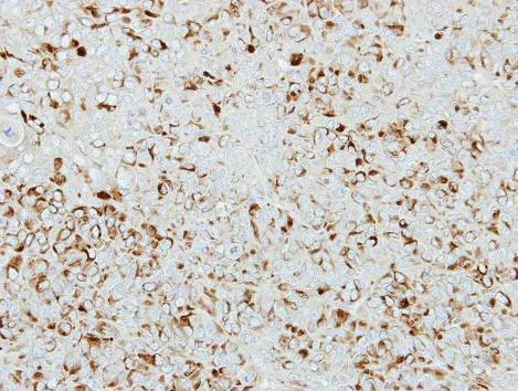 Immunohistochemistry (Formalin/PFA-fixed paraffin-embedded sections) - Anti-ICA69 antibody (AB154391)