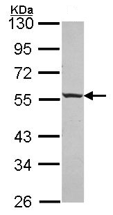 Western blot - Anti-ICA69 antibody (AB154391), expandable thumbnail