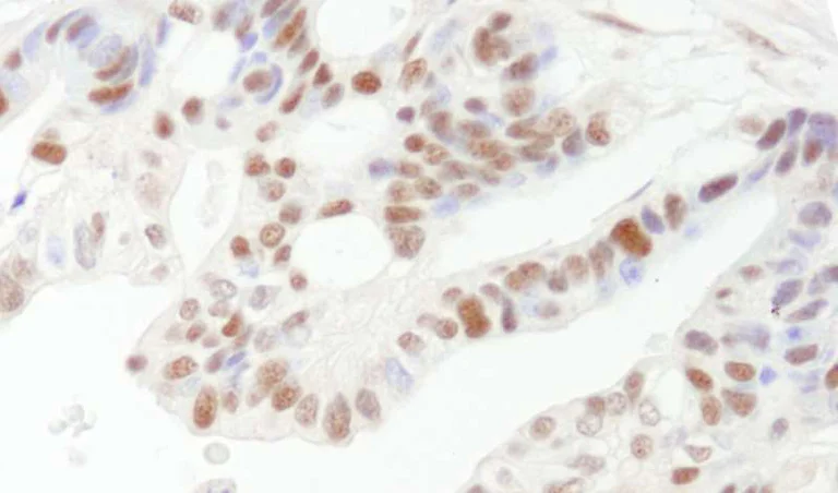 Immunohistochemistry (Formalin/PFA-fixed paraffin-embedded sections) - Anti-ICAD antibody (AB264202)