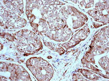 Immunohistochemistry (Formalin/PFA-fixed paraffin-embedded sections) - Anti-ICAD antibody [EPR4220] - BSA and Azide free (AB247711)