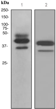 Western blot - Anti-ICAD antibody [EPR4220] - BSA and Azide free (AB247711)