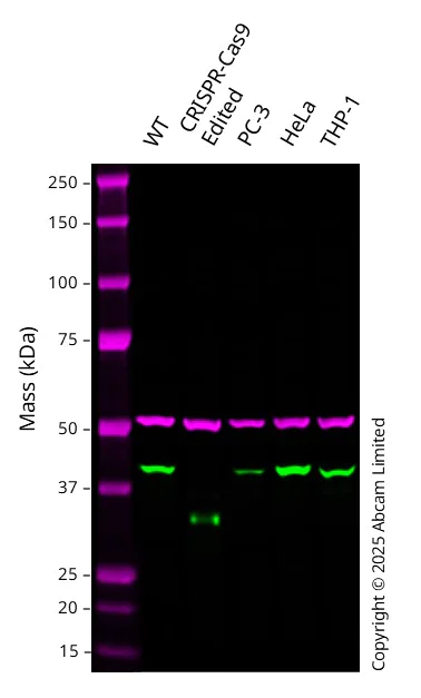 Western blot - Anti-ICAD antibody [EPR4221] - BSA and Azide free (AB248425)