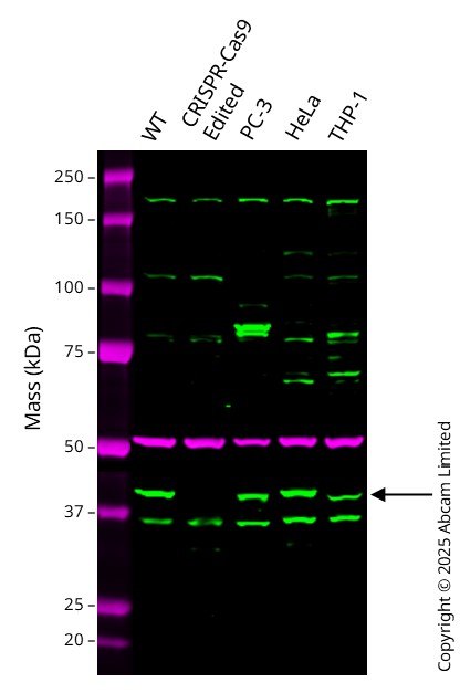 Western blot - Anti-ICAD antibody [EPR4222(2)] (AB108521)
