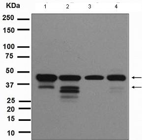 Western blot - Anti-ICAD antibody [EPR4222(2)] - BSA and Azide free (AB247681), expandable thumbnail