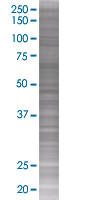 ICAD overexpression 293T lysate (whole cell)