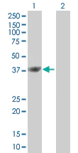 Western blot - ICAD overexpression 293T lysate (whole cell) (AB94130)
