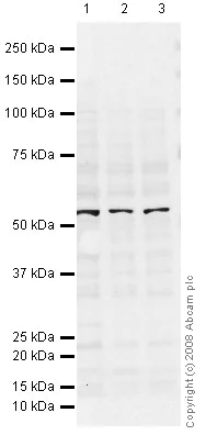 Western blot - Anti-ICAM1 antibody [15.2] (AB20)