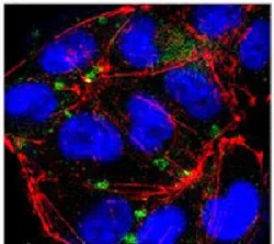 Immunocytochemistry - Anti-ICAM1 antibody [1A29] (AB171123)