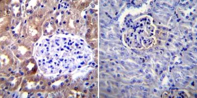 Immunohistochemistry (Formalin/PFA-fixed paraffin-embedded sections) - Anti-ICAM1 antibody [1A29] (AB171123)