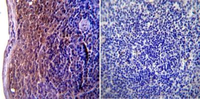 Immunohistochemistry (Formalin/PFA-fixed paraffin-embedded sections) - Anti-ICAM1 antibody [1A29] (AB171123)