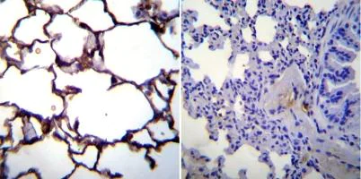 Immunohistochemistry (Formalin/PFA-fixed paraffin-embedded sections) - Anti-ICAM1 antibody [1A29] (AB171123)