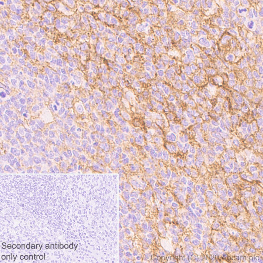 Immunohistochemistry (Formalin/PFA-fixed paraffin-embedded sections) - Anti-ICAM1 antibody [EP1442Y] - Low endotoxin, Azide free (AB221777)