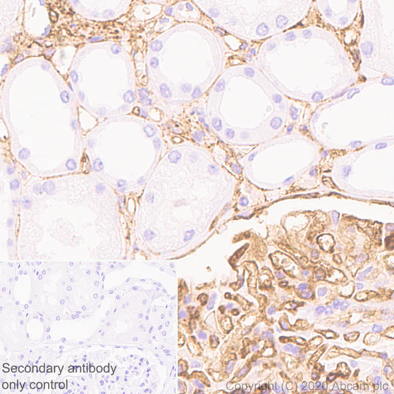 Immunohistochemistry (Formalin/PFA-fixed paraffin-embedded sections) - Anti-ICAM1 antibody [EP1442Y] - Low endotoxin, Azide free (AB221777)