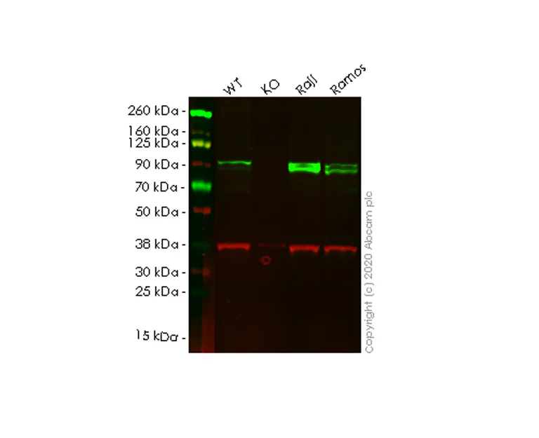 Western blot - Anti-ICAM1 antibody [EP1442Y] - Low endotoxin, Azide free (AB221777)