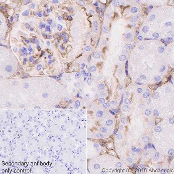 Immunohistochemistry (Formalin/PFA-fixed paraffin-embedded sections) - Anti-ICAM1 antibody [EPR16608] (AB179707)