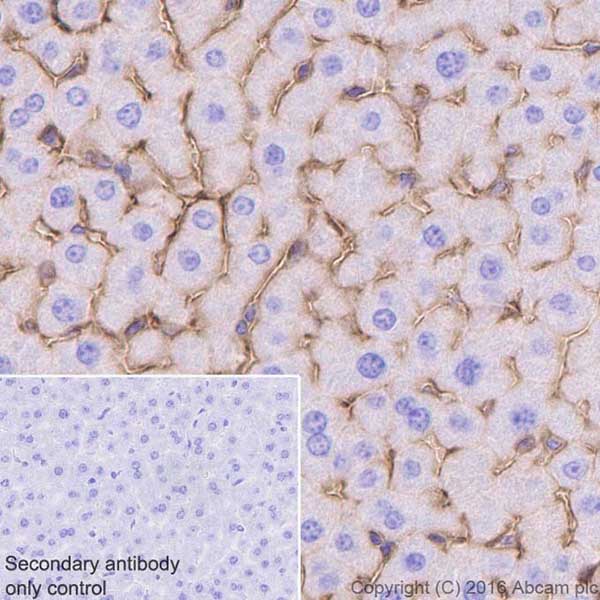 Anti-ICAM1 antibody [EPR16608]