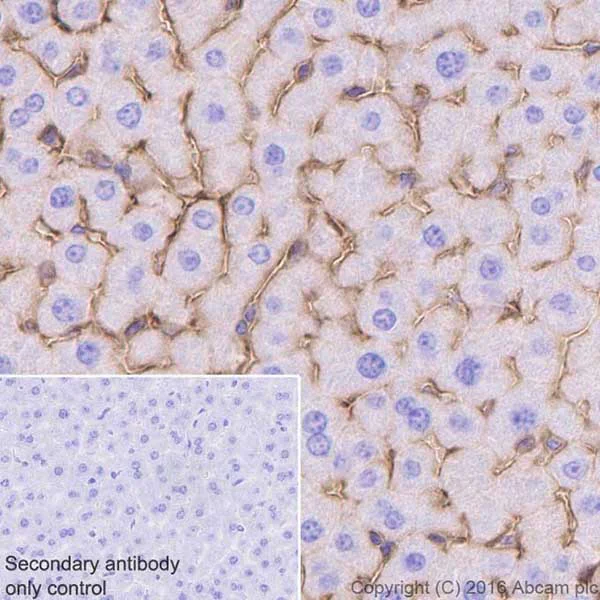 Immunohistochemistry (Formalin/PFA-fixed paraffin-embedded sections) - Anti-ICAM1 antibody [EPR16608] (AB179707)