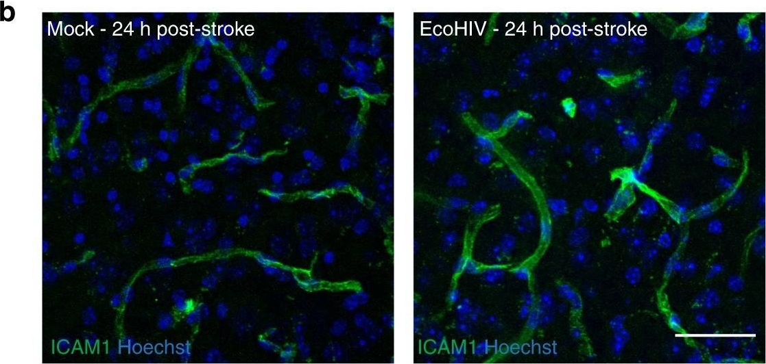 Immunohistochemistry - Anti-ICAM1 antibody [EPR16608] (AB179707)