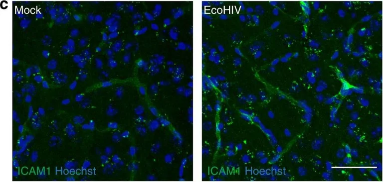 Immunohistochemistry - Anti-ICAM1 antibody [EPR16608] (AB179707)