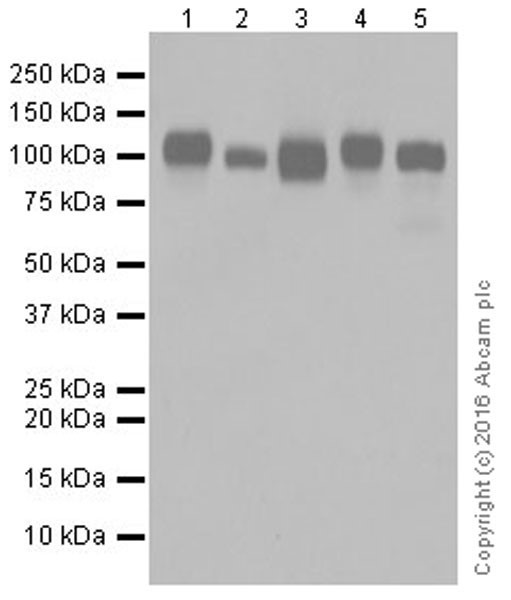 Western blot - Anti-ICAM1 antibody [EPR16608] (AB179707)