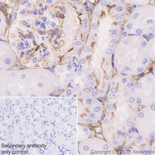 Immunohistochemistry (Formalin/PFA-fixed paraffin-embedded sections) - Anti-ICAM1 antibody [EPR16608] - Low endotoxin, Azide free (AB222498)