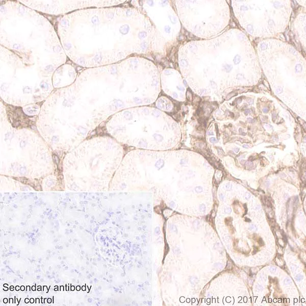 Immunohistochemistry (Formalin/PFA-fixed paraffin-embedded sections) - Anti-ICAM1 antibody [EPR19938] (AB206398)
