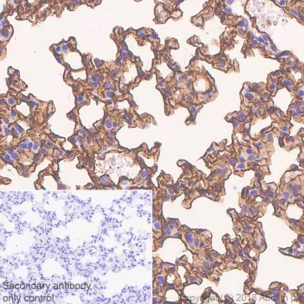Immunohistochemistry (Formalin/PFA-fixed paraffin-embedded sections) - Anti-ICAM1 antibody [EPR22161-284] - BSA and Azide free (AB239401)