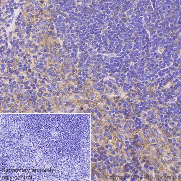 Immunohistochemistry (Formalin/PFA-fixed paraffin-embedded sections) - Anti-ICAM1 antibody [EPR22161-284] - BSA and Azide free (AB239401)