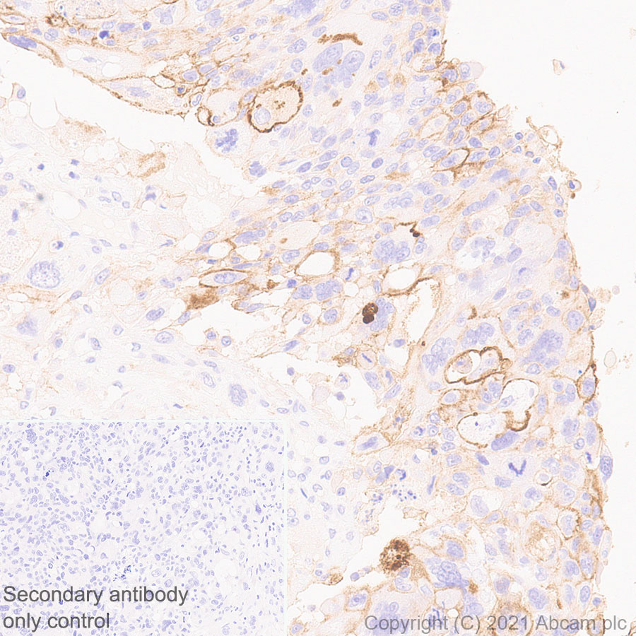 Immunohistochemistry (Formalin/PFA-fixed paraffin-embedded sections) - Anti-ICAM1 antibody [EPR24639-3] (AB282575)