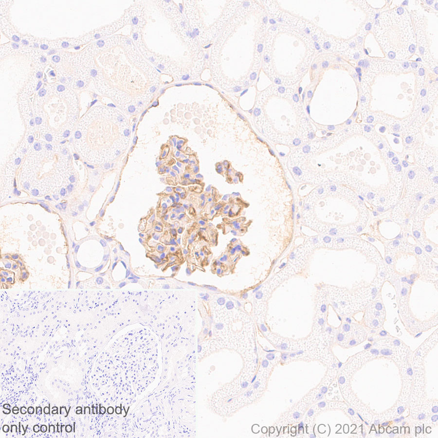Immunohistochemistry (Formalin/PFA-fixed paraffin-embedded sections) - Anti-ICAM1 antibody [EPR24639-3] (AB282575)