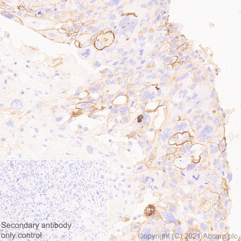 Immunohistochemistry (Formalin/PFA-fixed paraffin-embedded sections) - Anti-ICAM1 antibody [EPR24639-3] - BSA and Azide free (AB282599)