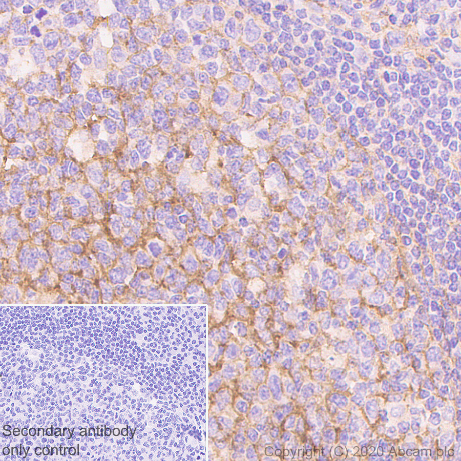 Immunohistochemistry (Formalin/PFA-fixed paraffin-embedded sections) - Anti-ICAM1 antibody [EPR4776] (AB109361)