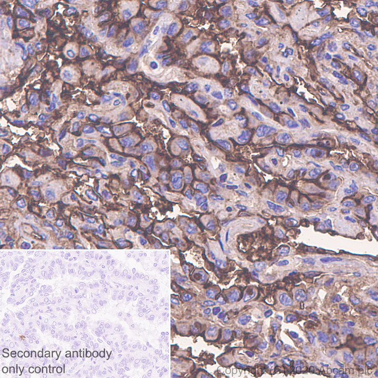 Immunohistochemistry (Formalin/PFA-fixed paraffin-embedded sections) - Anti-ICAM1 antibody [EPR4776] (AB109361)