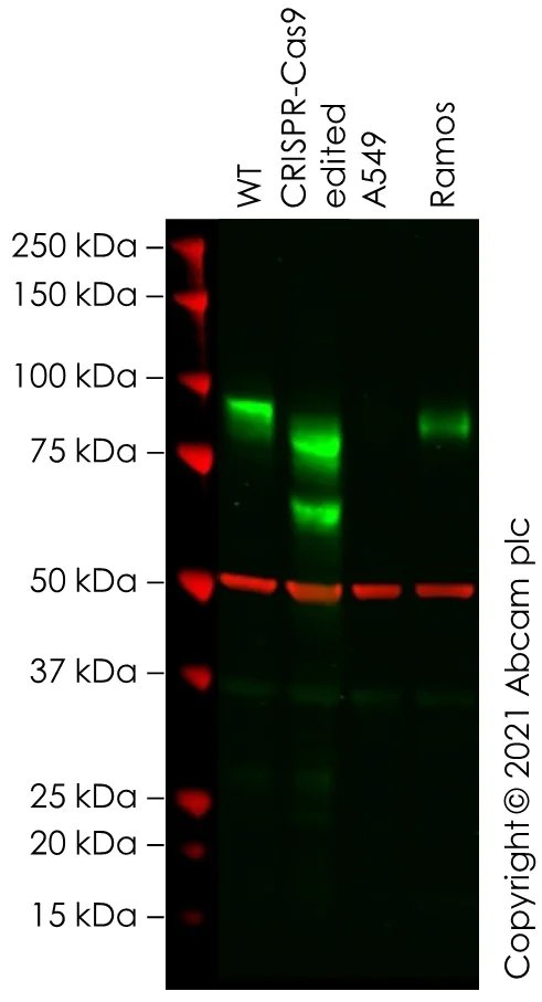 Western blot - Anti-ICAM1 antibody [EPR4776] (AB109361)