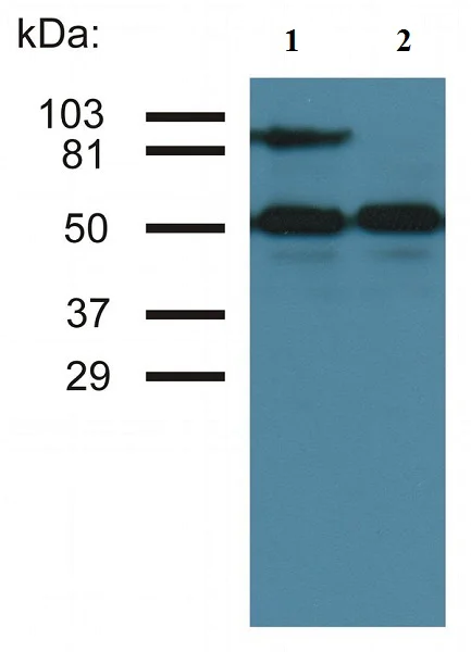Western blot - Anti-ICAM1 antibody [MEM-111] (AB2213)